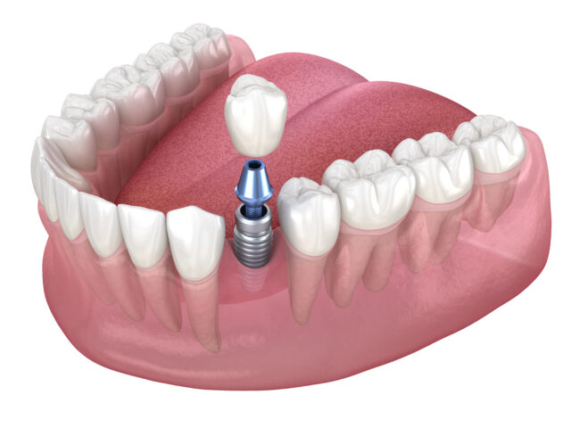 https://www.docteur-helie.fr/wp-content/uploads/2024/05/shutterstock_1673668807-640x480.jpg
