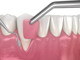 https://www.docteur-helie.fr/wp-content/uploads/2024/05/shutterstock_1741122335-320x240.jpg