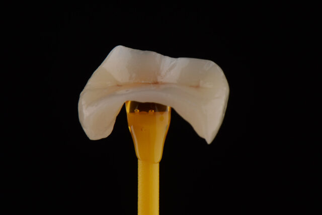 https://www.docteur-helie.fr/wp-content/uploads/2024/05/shutterstock_1824096062-1-640x427.jpg