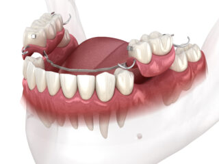 https://www.docteur-helie.fr/wp-content/uploads/2024/05/shutterstock_1845531640-320x240.jpg