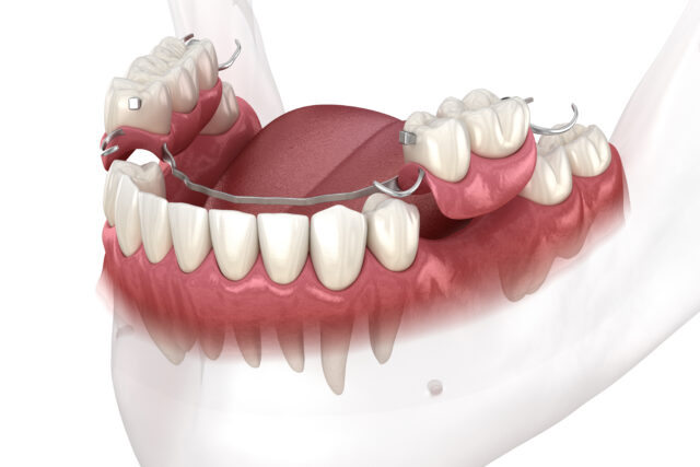 https://www.docteur-helie.fr/wp-content/uploads/2024/05/shutterstock_1845531640-640x427.jpg