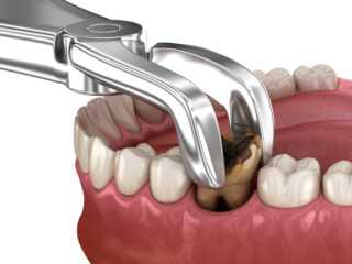 https://www.docteur-helie.fr/wp-content/uploads/2024/05/shutterstock_1955865490-320x240.jpg
