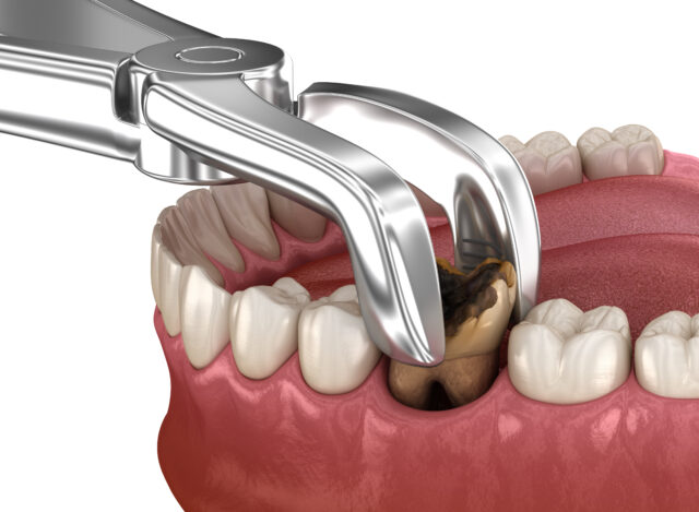 https://www.docteur-helie.fr/wp-content/uploads/2024/05/shutterstock_1955865490-640x469.jpg