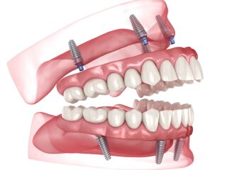 https://www.docteur-helie.fr/wp-content/uploads/2024/05/shutterstock_2283993533-320x240.jpg